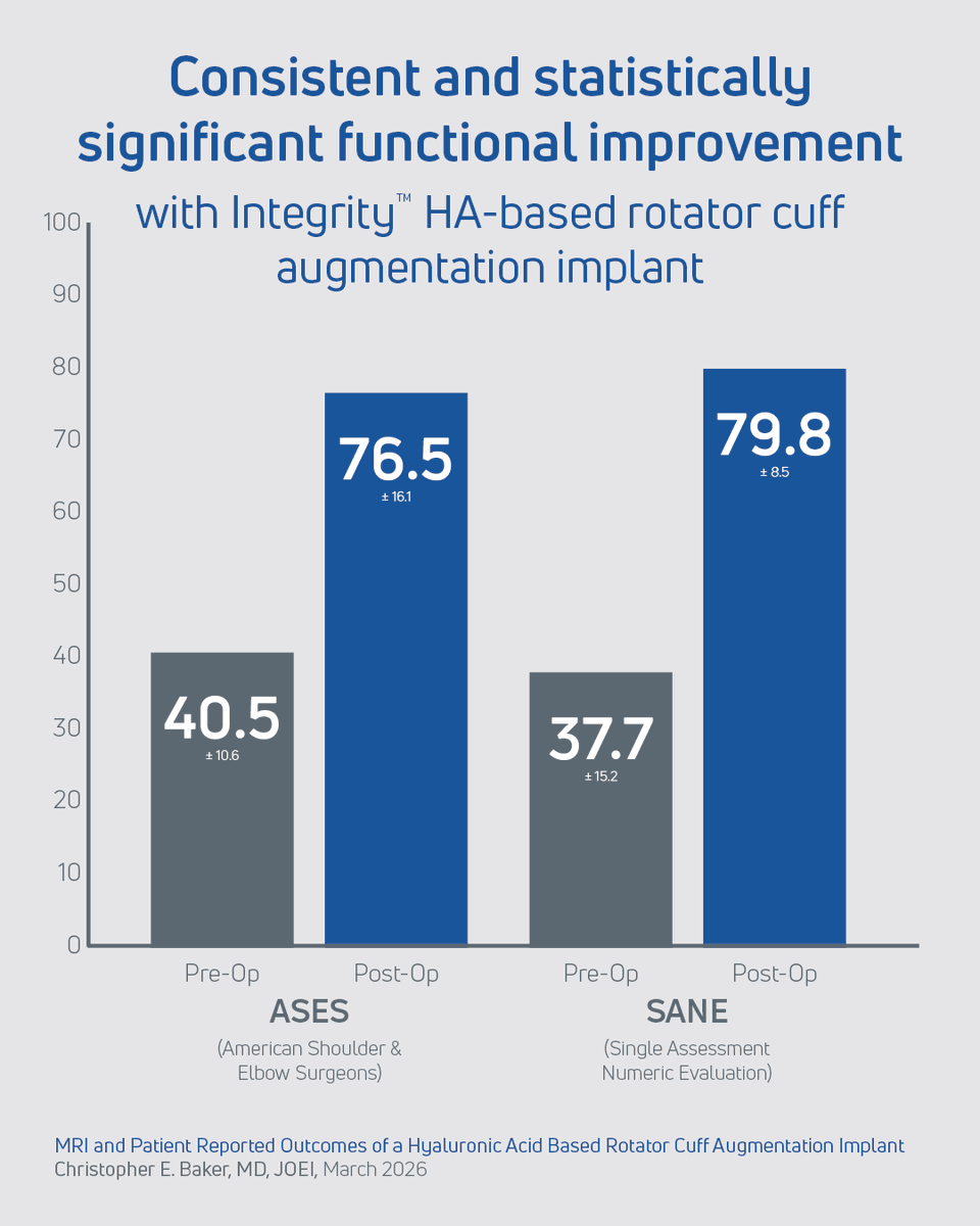 AnikaThera's tweet image. How can Integrity help improve rotator cuff function scores? Read Dr. Christopher E. Baker’s publication to find out! ow.ly/YPOM50YCwKW

#RotatorCuffRepair #PatientOutcomes #ShoulderSurgery #IntegrityImplant