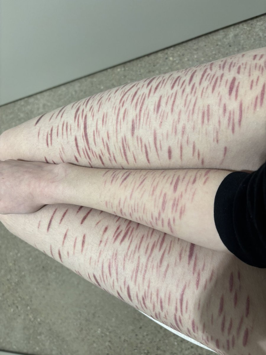 whatever tweet media