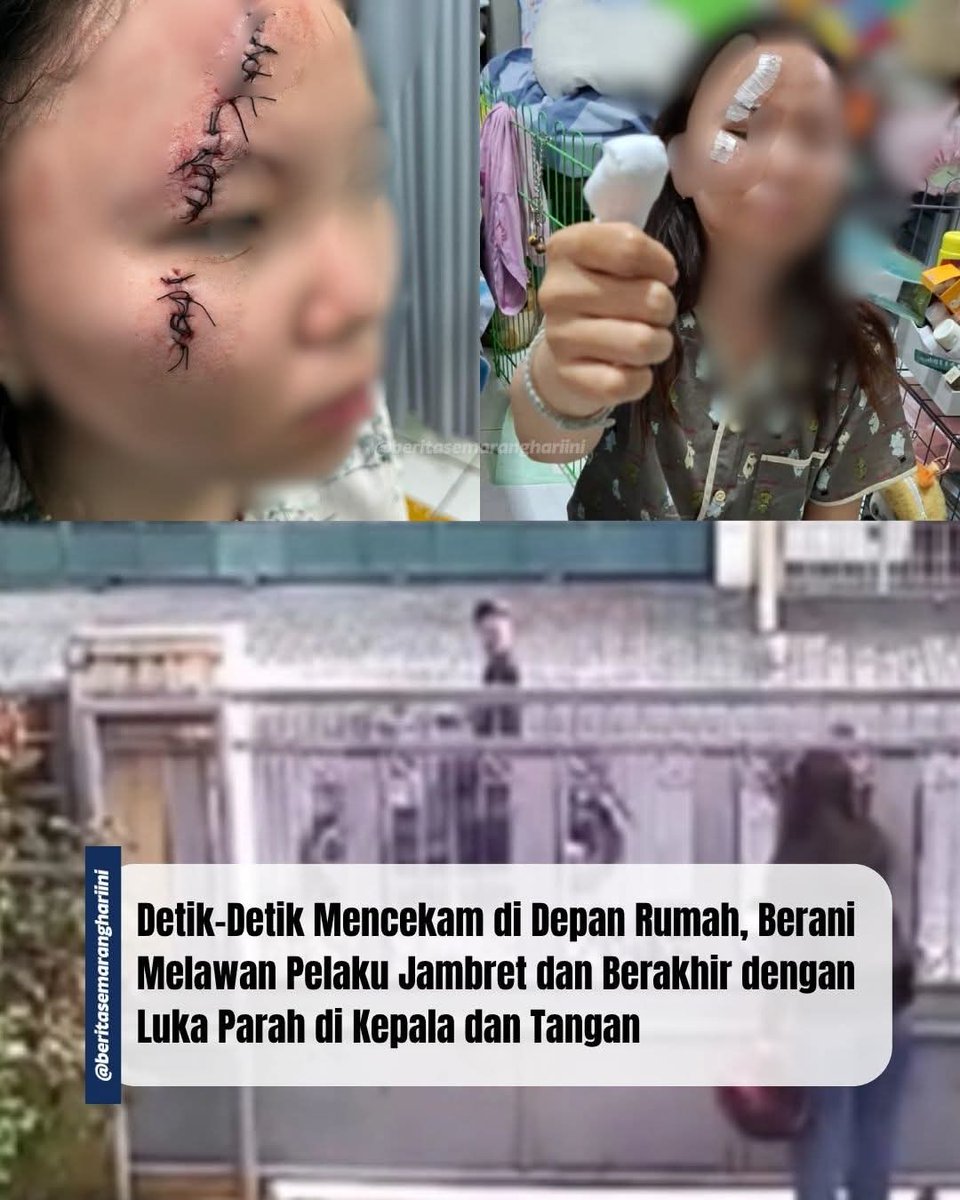 Call Me Ngkong Roses🌹 tweet media