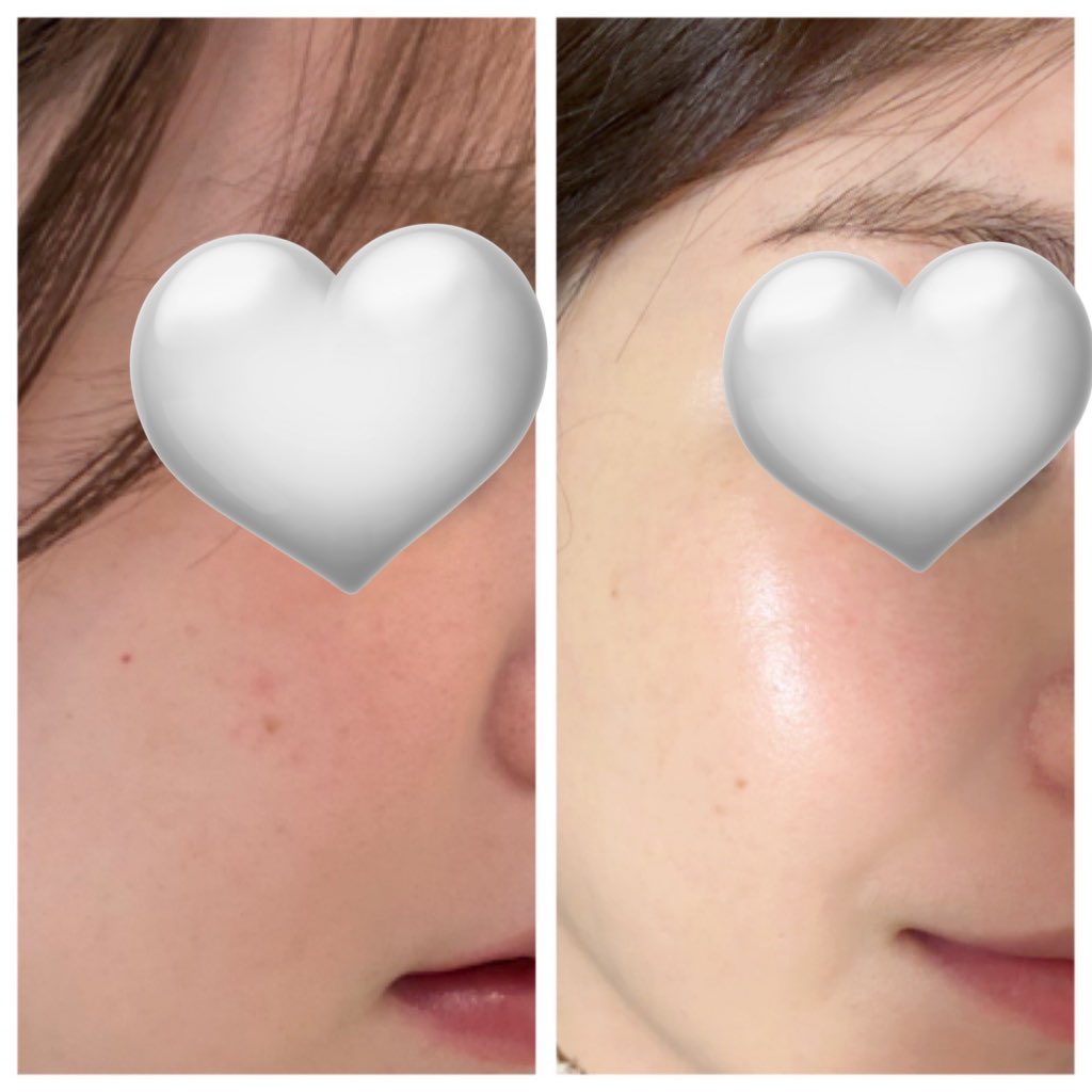 ❤︎ 鼻DT中 tweet media