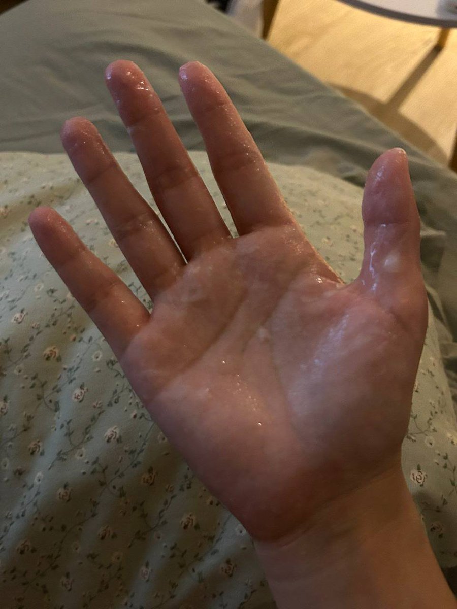 想變白的小黑🥣 tweet media