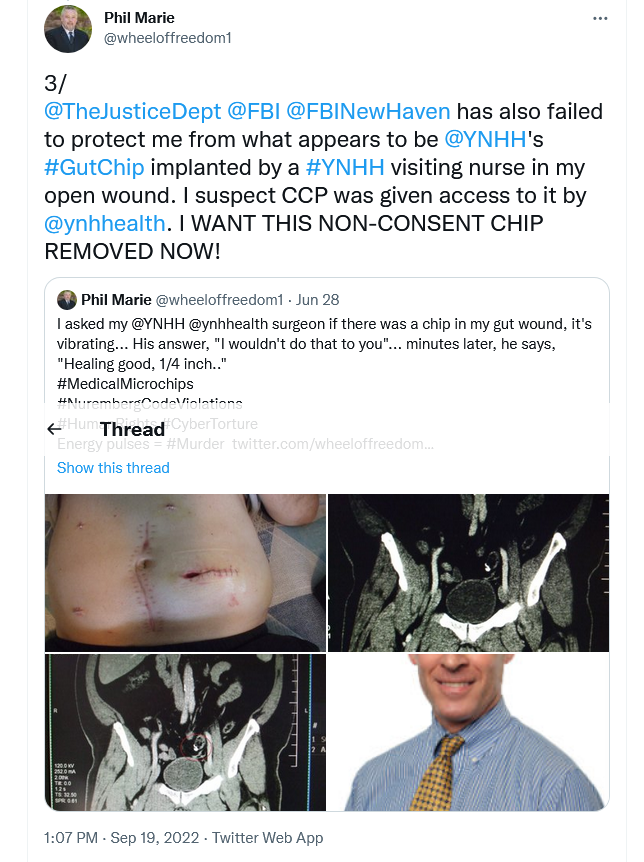 wheeloffreedom1's tweet photo. #BiochipTerrorists😠🖥️attack me🛰️⚡️during phone calls,
esp work related, like talking to my boss, BT's want control.
These demons want control of my life, what I think, say, & do,
and they want me to renounce my faith in Jesus Christ✝️
THE LORD GOD ALMIGHTY WILL END ALL OF THIS⚠️ https://t.co/zQtWqPG2Vt