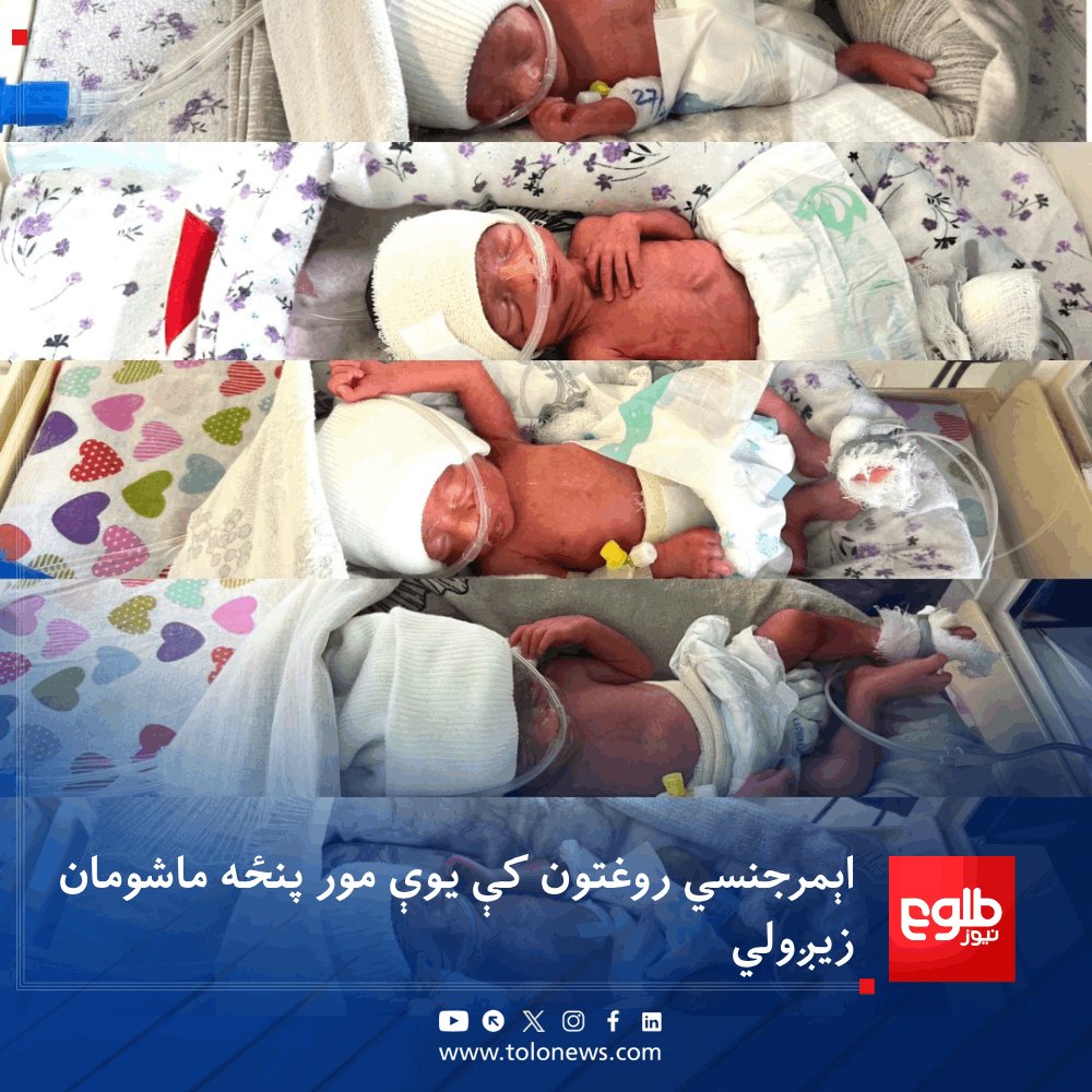 TOLOnews tweet media