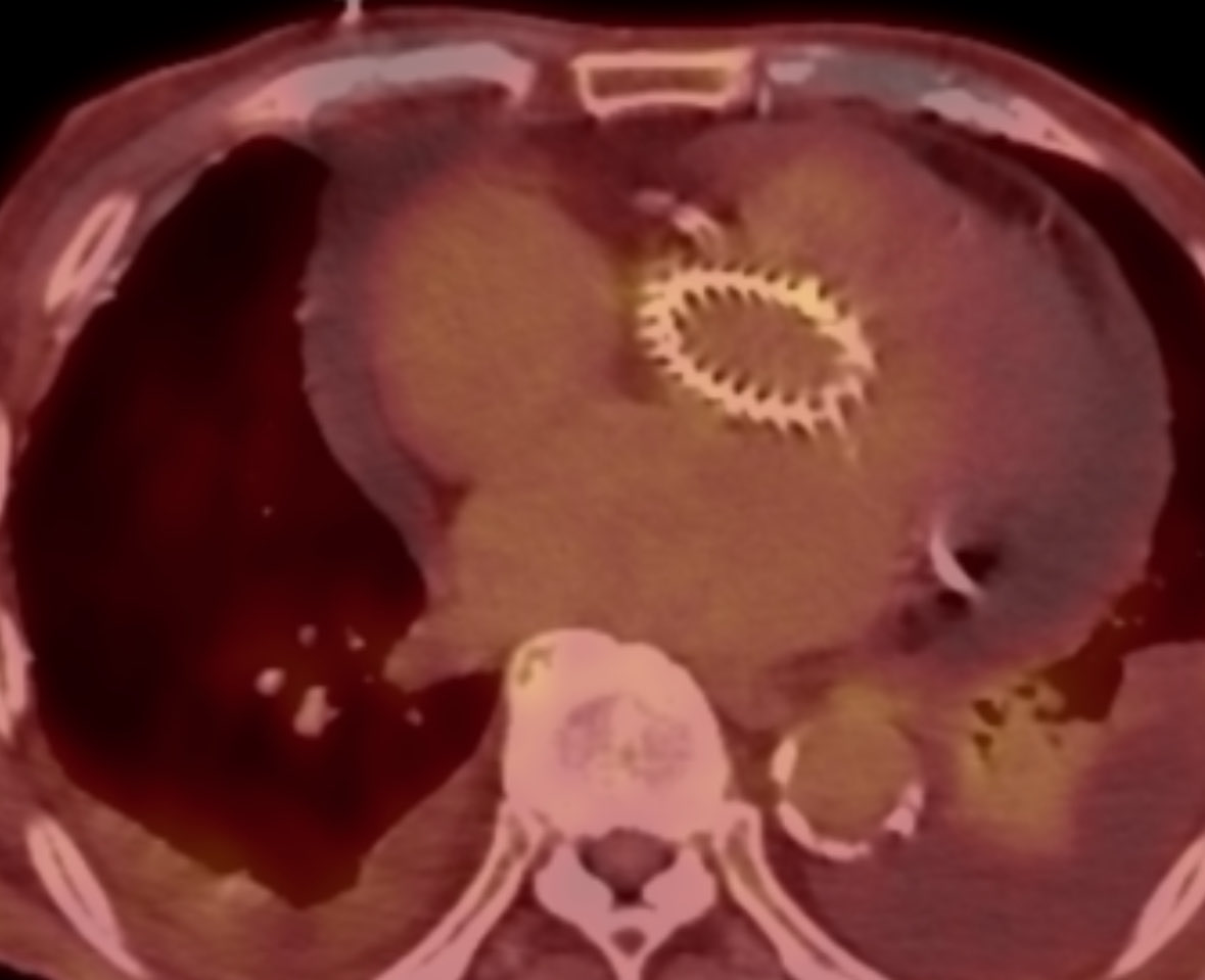 궁서체 tweet media