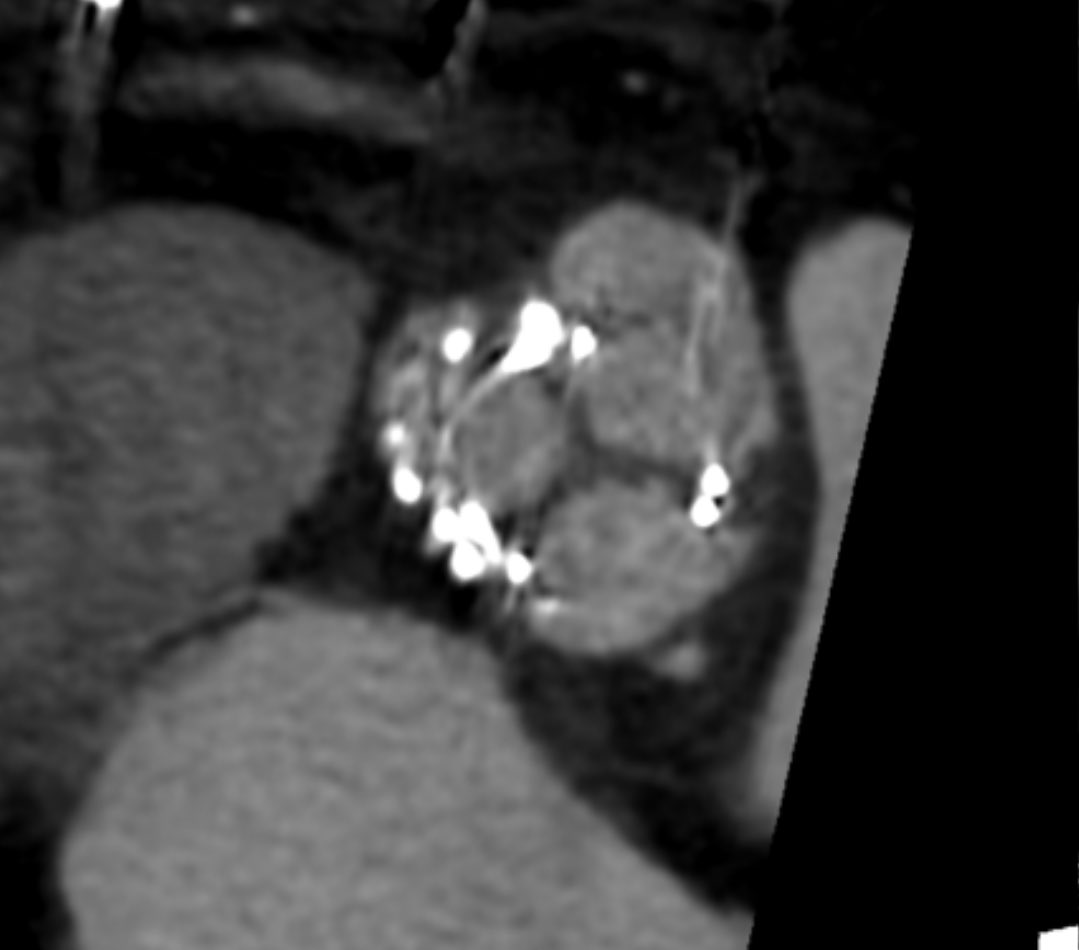 궁서체 tweet media