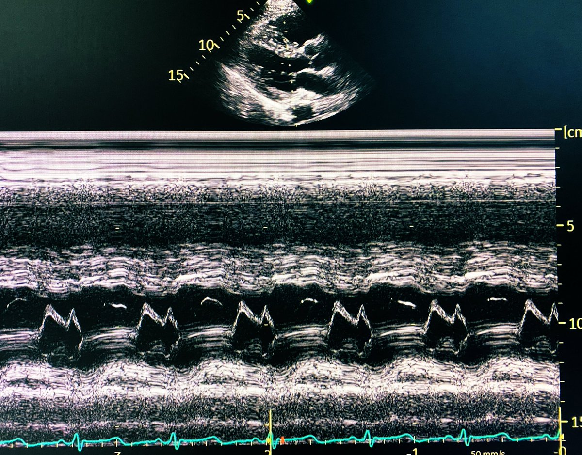 Mehnaz Rahman, M.D. tweet media
