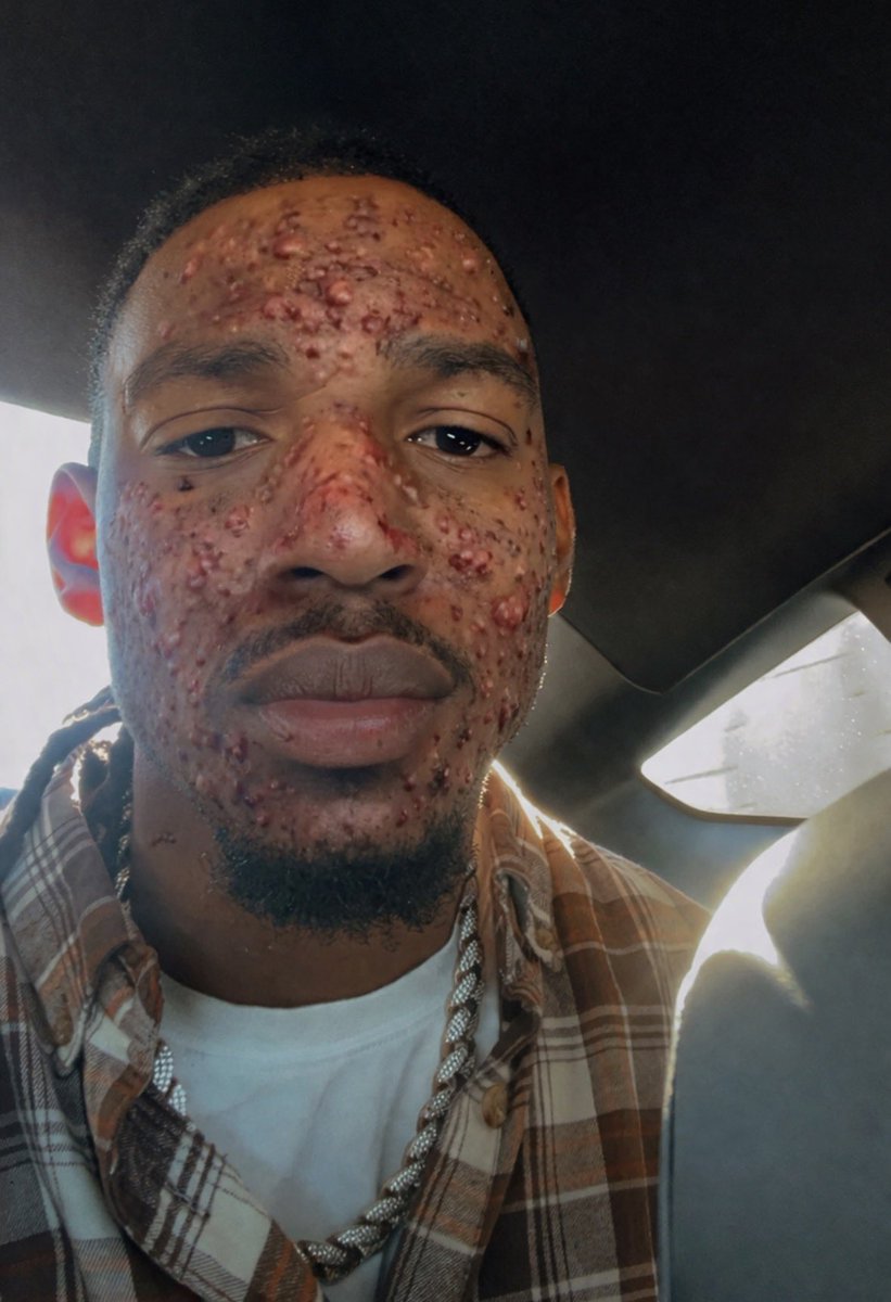 B Lou Updates 🌟 tweet media