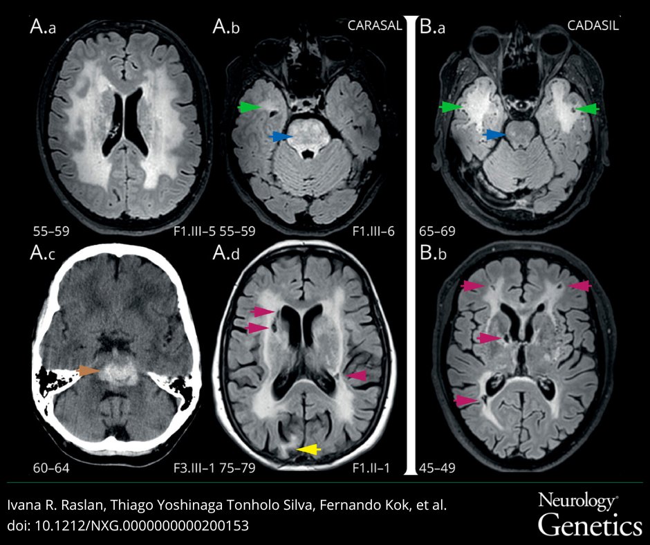 Neurology Journal tweet media