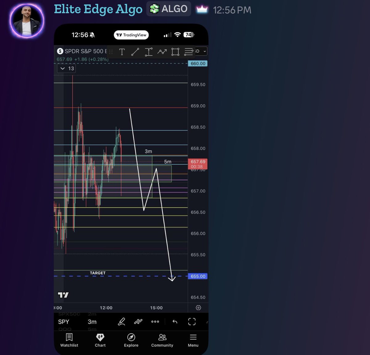 Elite Edge Algo tweet media