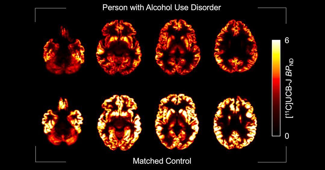 Journal of Clinical Investigation tweet media