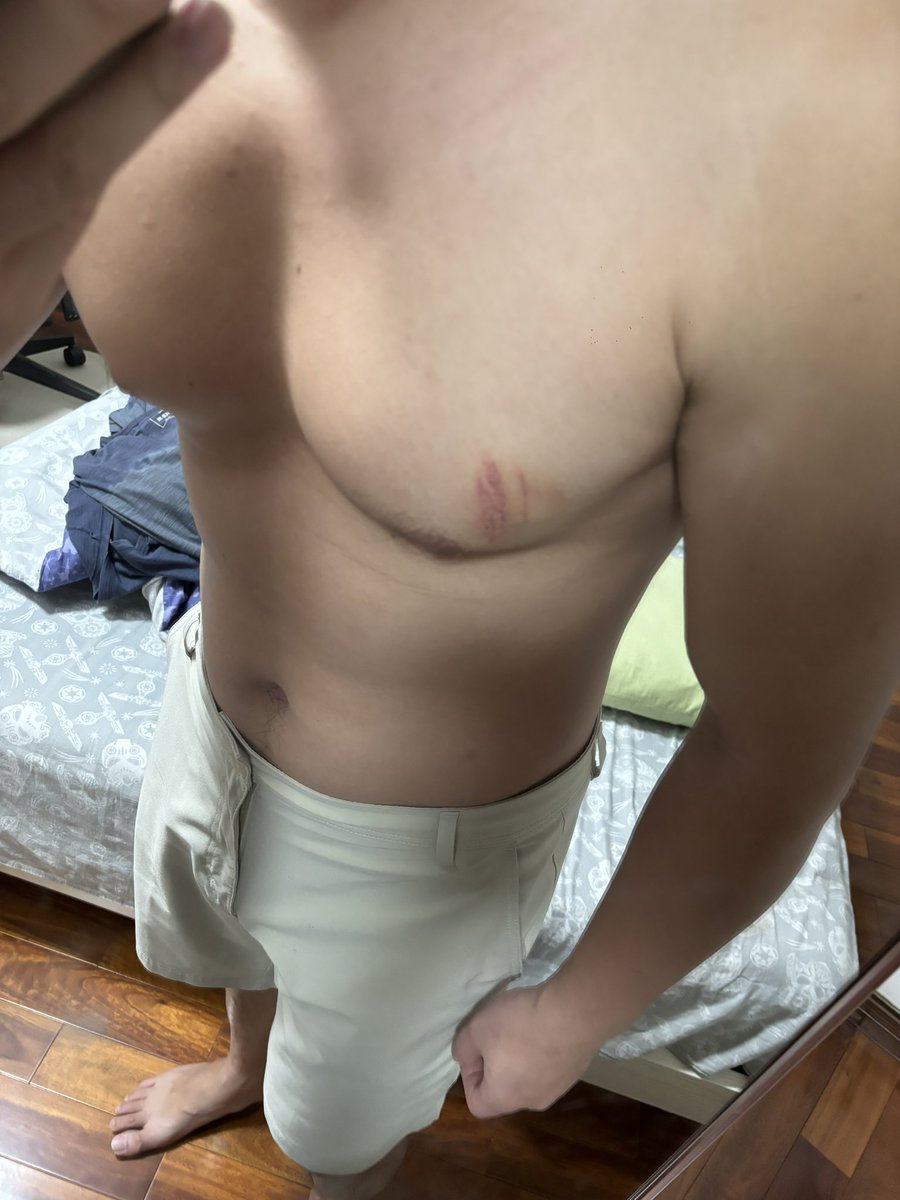 骚年的你 tweet media