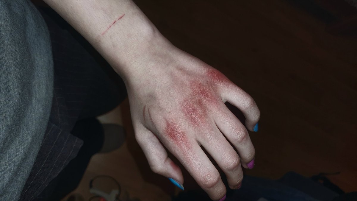 🩻𝘣𝘢𝘣𝘺𝘣𝘭𝘶𝘦 - 𝘴𝘩𝘦𝘥𝘵𝘸𝘵 ₤ò益óꀣ tweet media