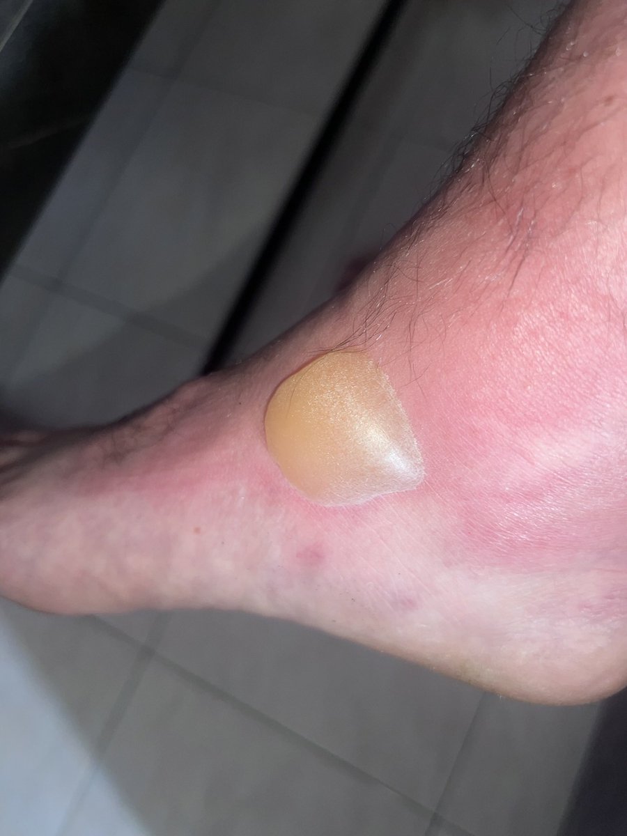 Scotian82 tweet media