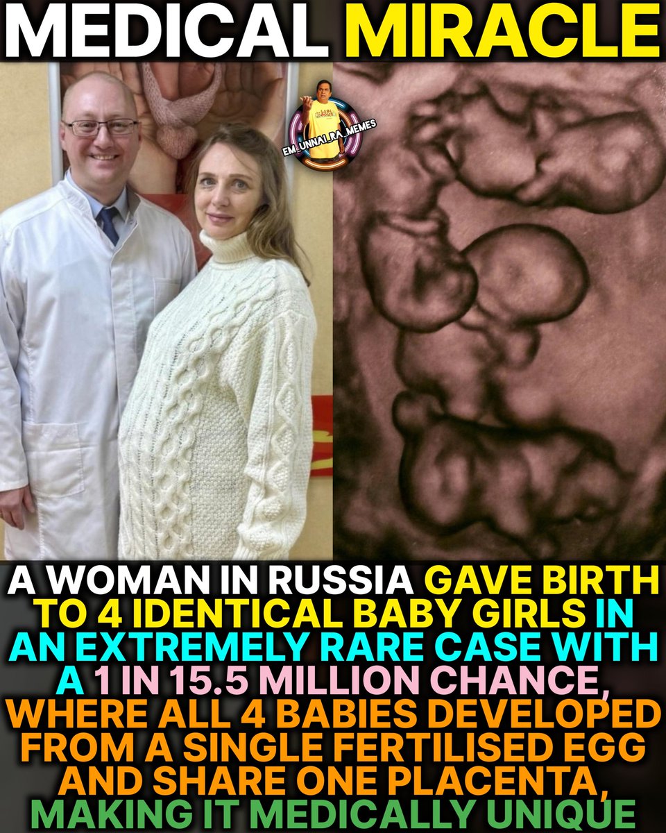 eurm_official's tweet photo. Babies kuda healthy ganey unnaru anta...chala rare case
#em_unnai_ra_memes #eurm #RussiaNews #MedicalRare #WorldNews https://t.co/ZrHxzOUB9u