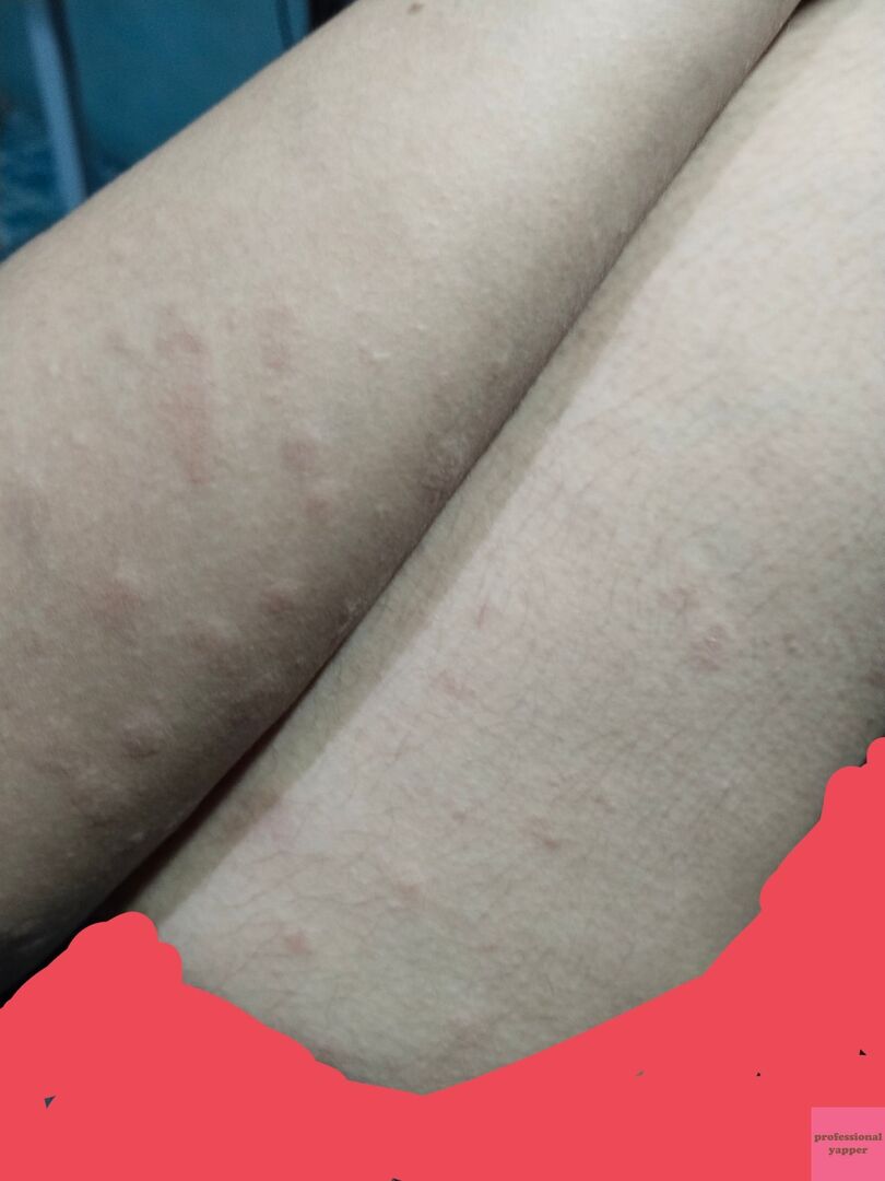 YAPPINGFESS tweet media