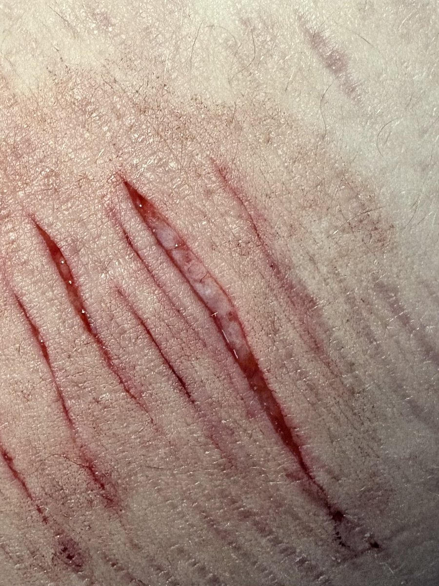 ๐ธ๐๐๐๐๐ฑ๐๐๐๐ ๐บ๐ ๐พ๐๐๐๐ tweet media