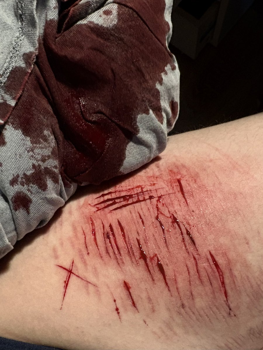 ๐ธ๐๐๐๐๐ฑ๐๐๐๐ ๐บ๐ ๐พ๐๐๐๐ tweet media