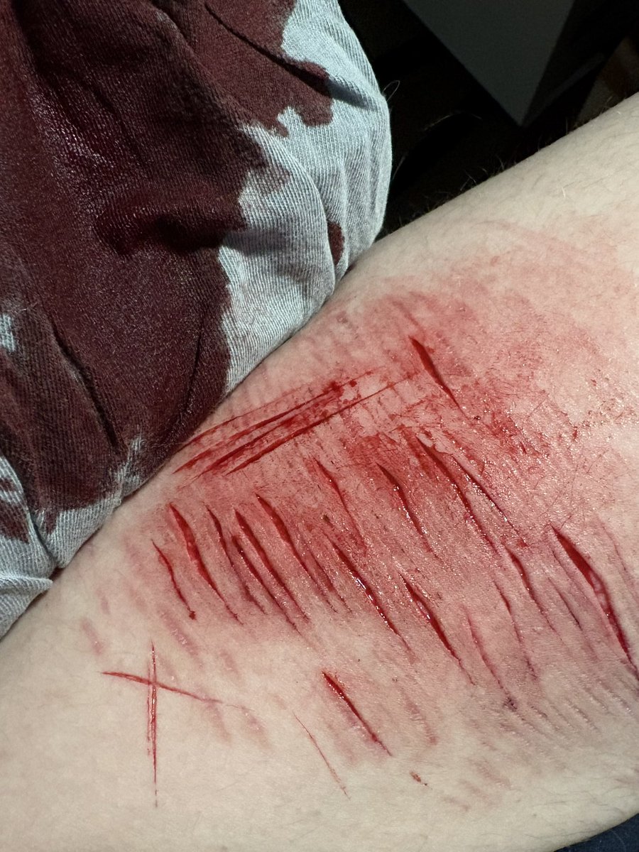 ๐ธ๐๐๐๐๐ฑ๐๐๐๐ ๐บ๐ ๐พ๐๐๐๐ tweet media