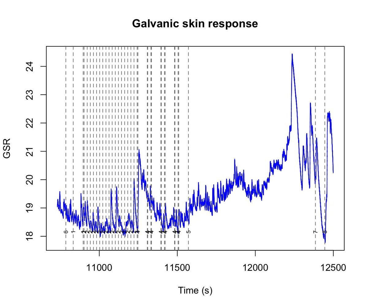 NicoleRPrause's tweet photo. We are n=49 in our male orgasm study.
These data are looking so clean!
Galvanic skin response (from foot)
Pneumatic response (from anus)
Temperature (from neck) https://t.co/LyVk0wiRB8