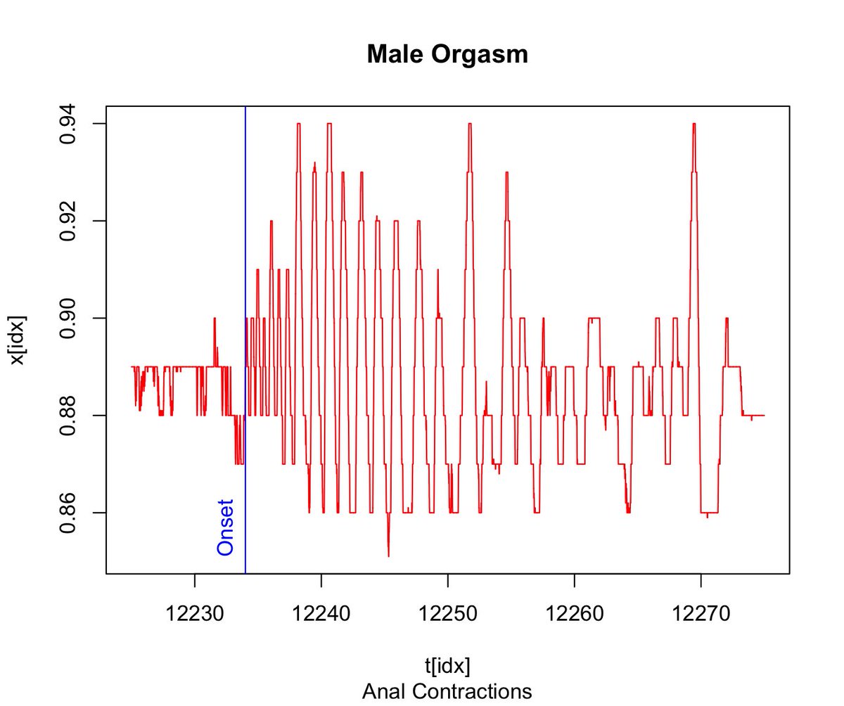 NicoleRPrause's tweet photo. We are n=49 in our male orgasm study.
These data are looking so clean!
Galvanic skin response (from foot)
Pneumatic response (from anus)
Temperature (from neck) https://t.co/LyVk0wiRB8