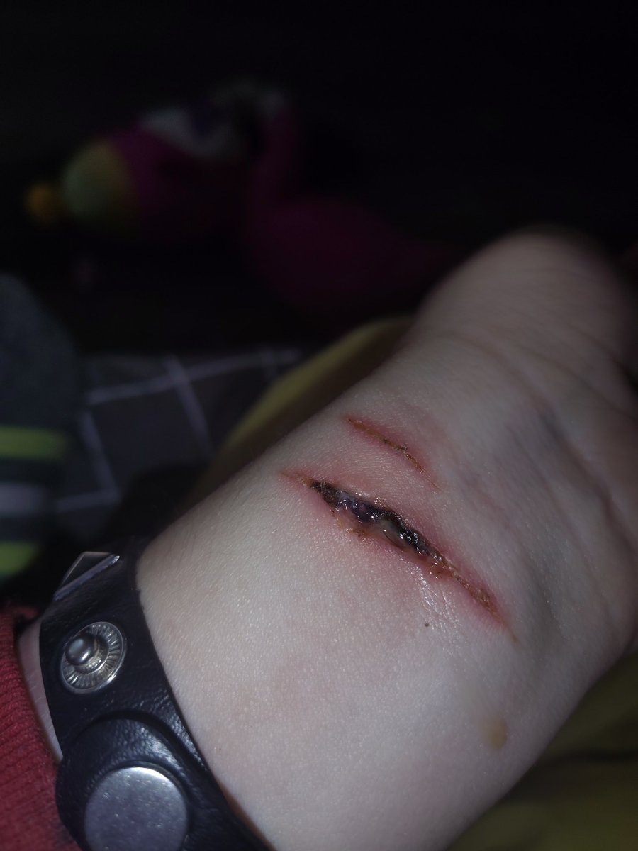 KARKAT OF #SHEDTWT 🩸 tweet media