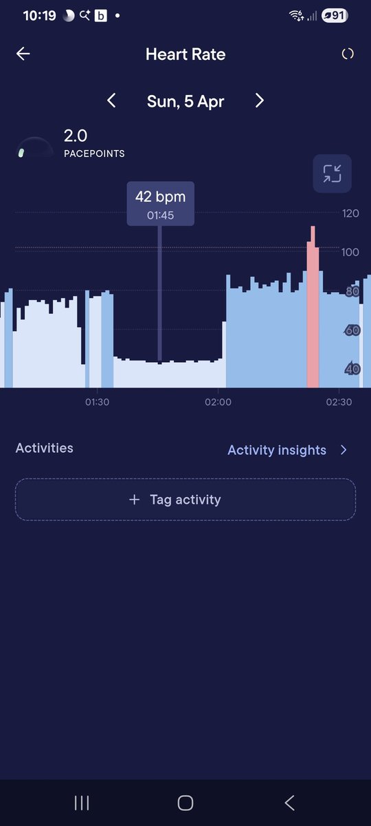 Mikeblackeruk's tweet photo. The Joy's of a faulty autonomous nervous system. All the things people do without thinking. Like breathing, blood pressure, heart rate, my system gets mixed up signals. Hence the very low heart rate. https://t.co/WpGAtmJH4A