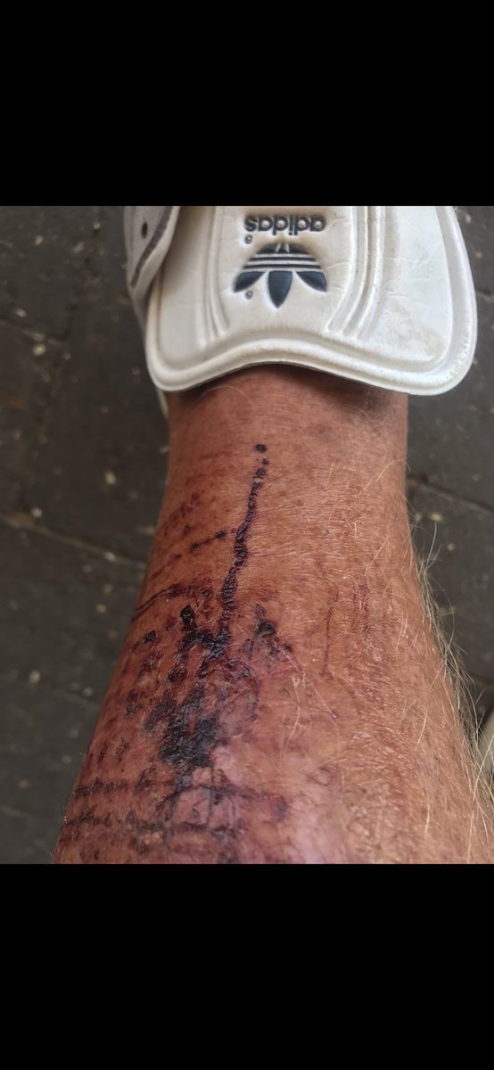 rodbishop15's tweet photo. I tackled a repeat offender, nuisance #shoplifter in a Harlow petrol station 4 years ago. Black dude just stuffing his jacket full of chocolate.
I warned him, then tackled him. We fell over a metal display stand and I cut my leg. ( it looks worse than it was).
He left the store, I paid for my fuel and the Asian owner never thanked me. Just stood behind his screen shouting obscenities at the guy. Said he comes in most days and robs him!
I went outside and MrsB sitting in the car said…..you were a long while!
The shoplifter stood on the road just past the petrol station and shouted shit to me as I drove off. Mrs B said….strange bloke! 🤷🤭
#Shoplifting #Waitrose