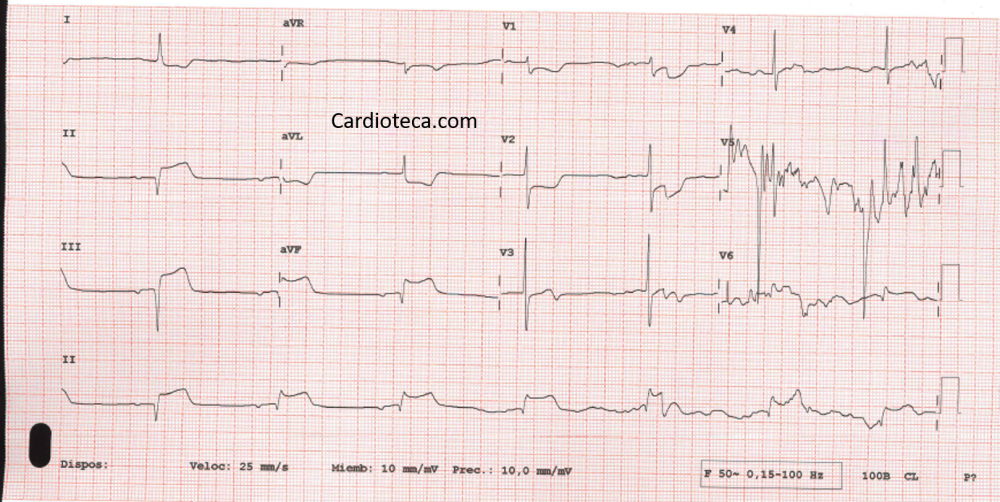 CardioTeca tweet media