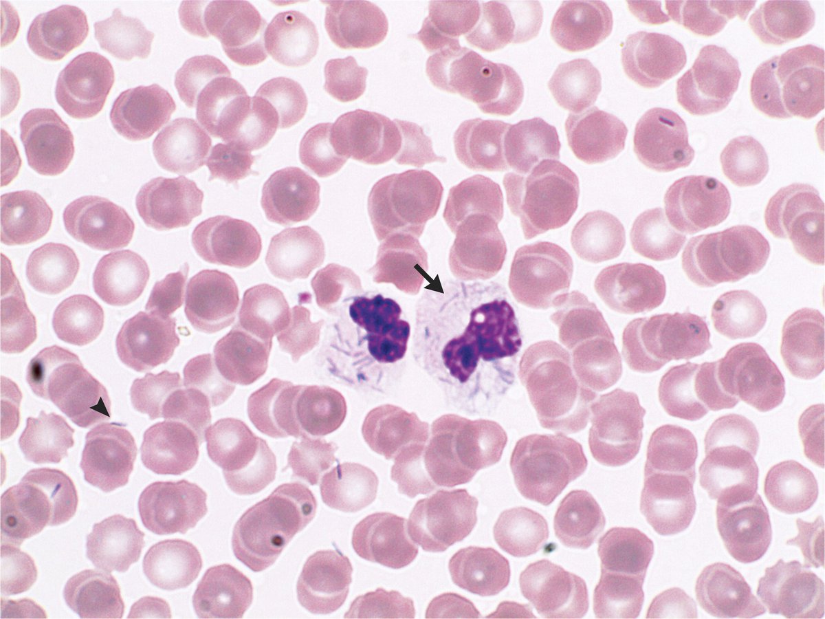 RaviMedTest #2MIR27 #2MIR28 tweet media