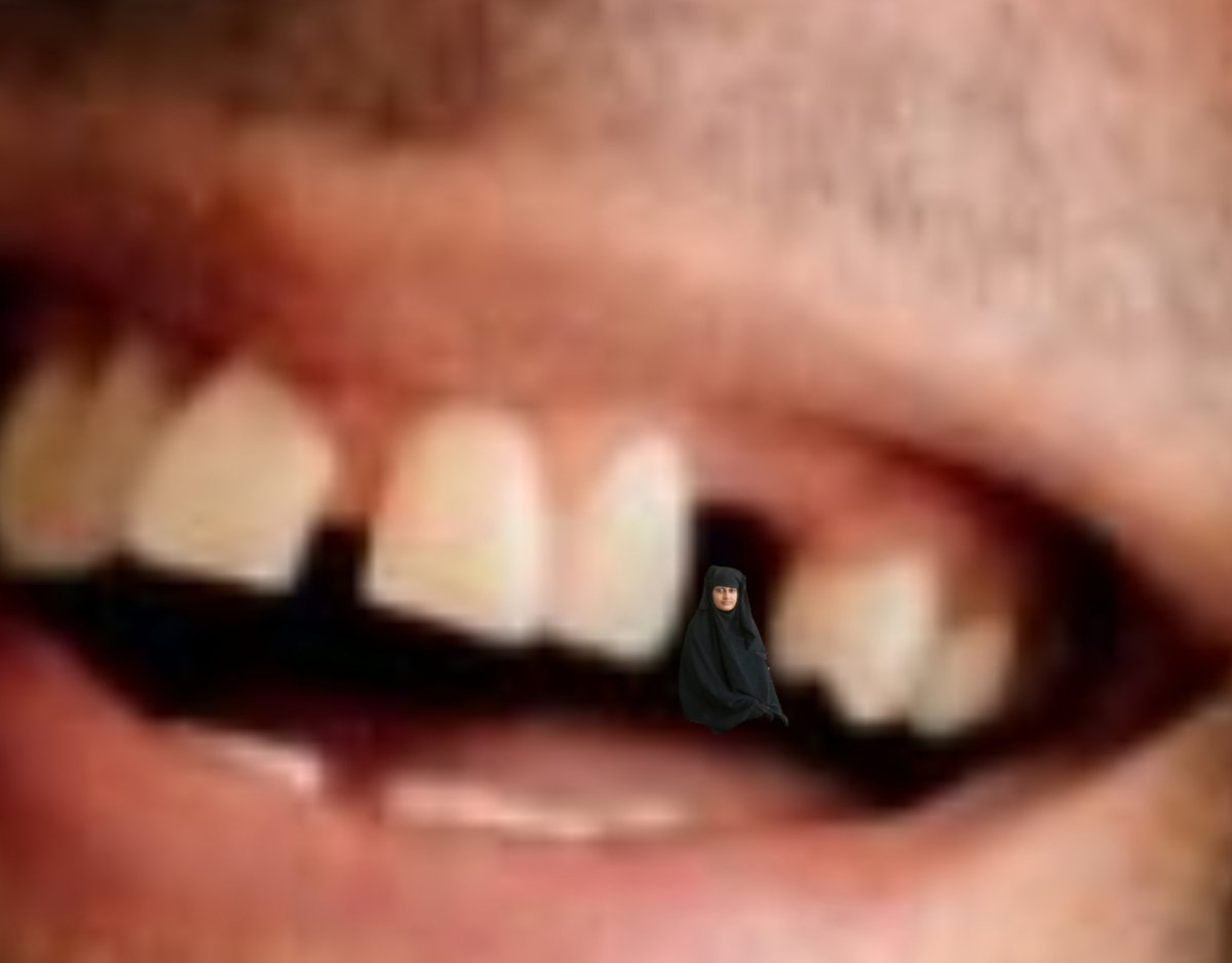 Burnside tweet media