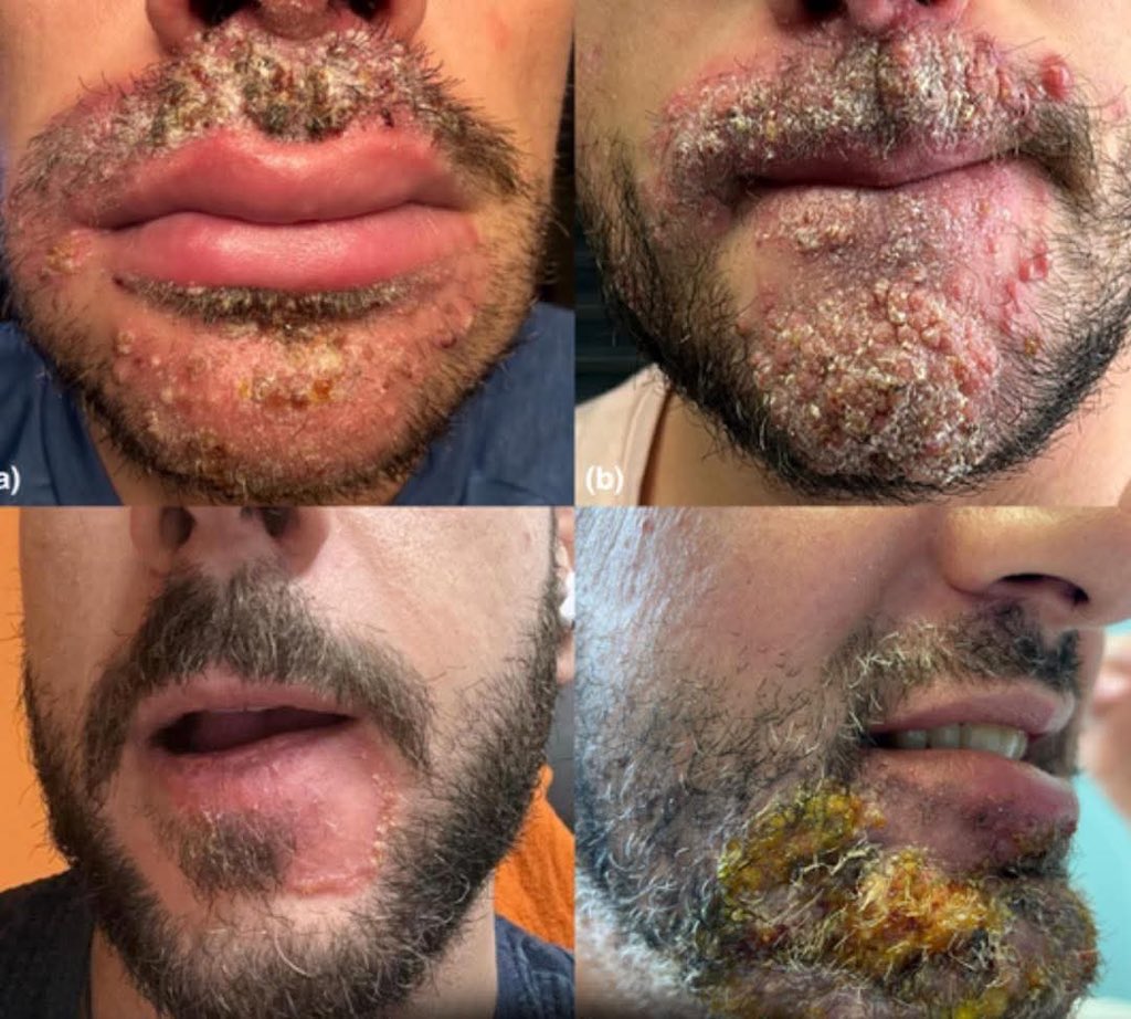 Black_Melanin🥰 tweet media