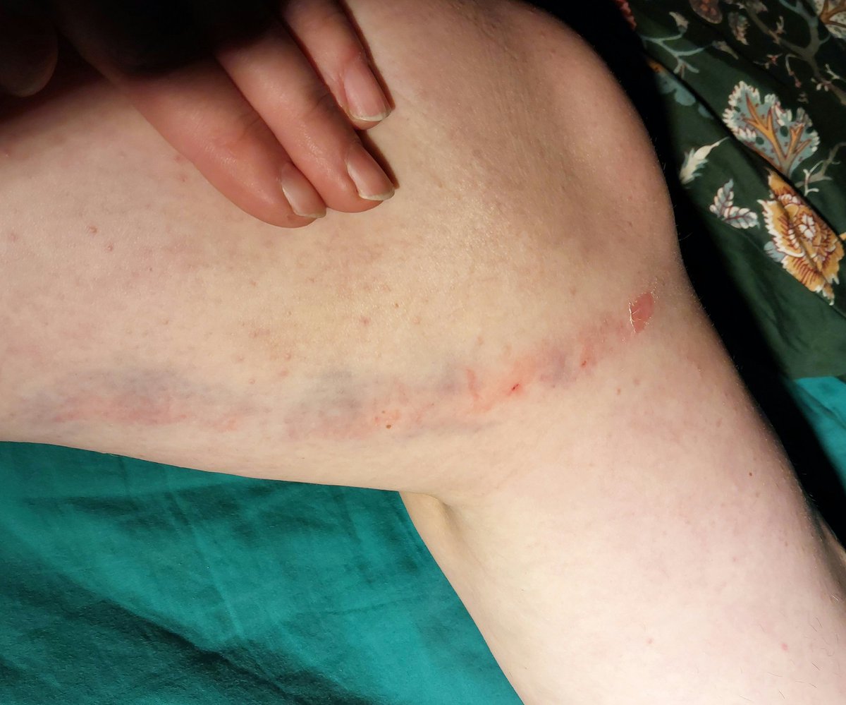 enelka🐿 tweet media