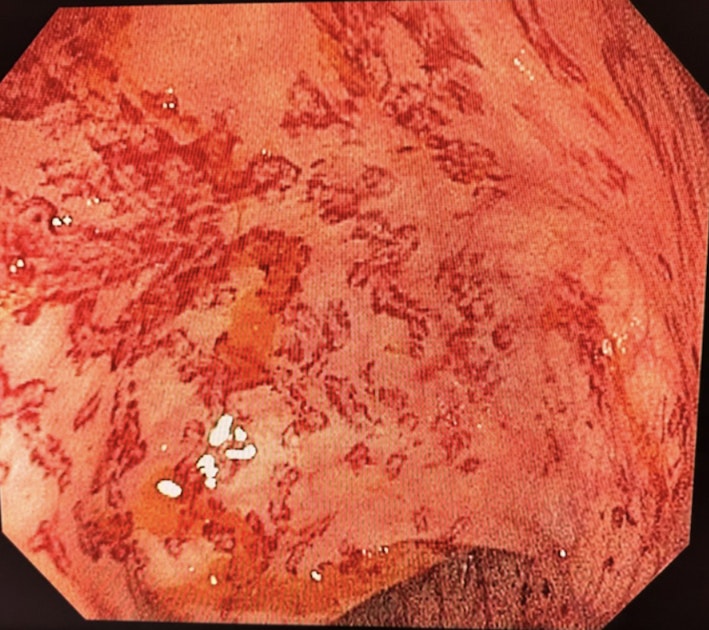 EndoCollab™ | GI Endoscopy Community tweet media