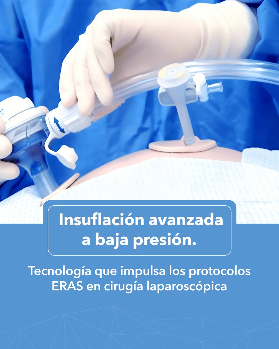 primendocirugia's tweet image. Un estudio en Surgical Endoscopy confirma que la laparoscopia a baja presión con insuflación avanzada mejora la recuperación en protocolos #ERAS. Mantener un neumoperitoneo estable a 8–9 mmHg optimiza la cirugía y reduce el impacto en el paciente. 📑🚀

🔗 airseal.prim.es