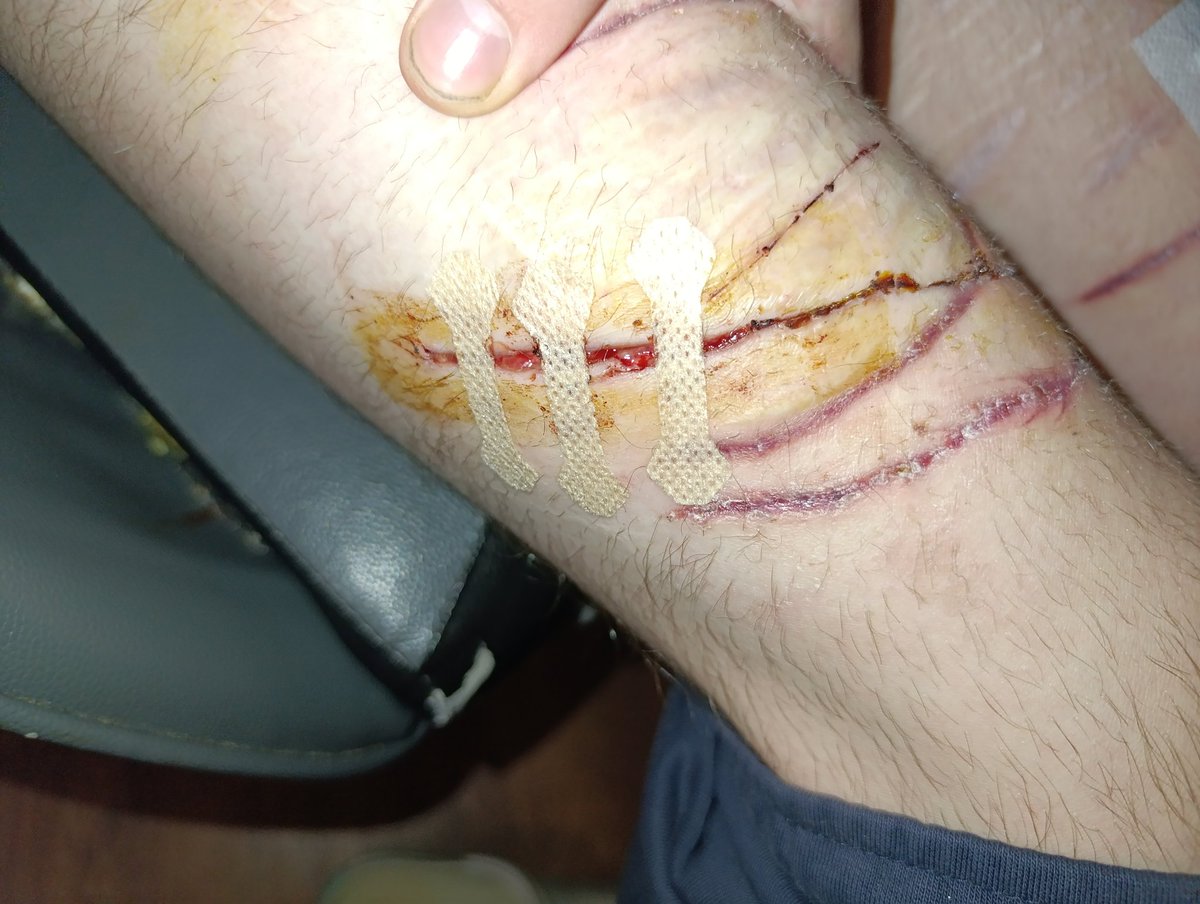 wayoutofthiscity #shtwt tweet media