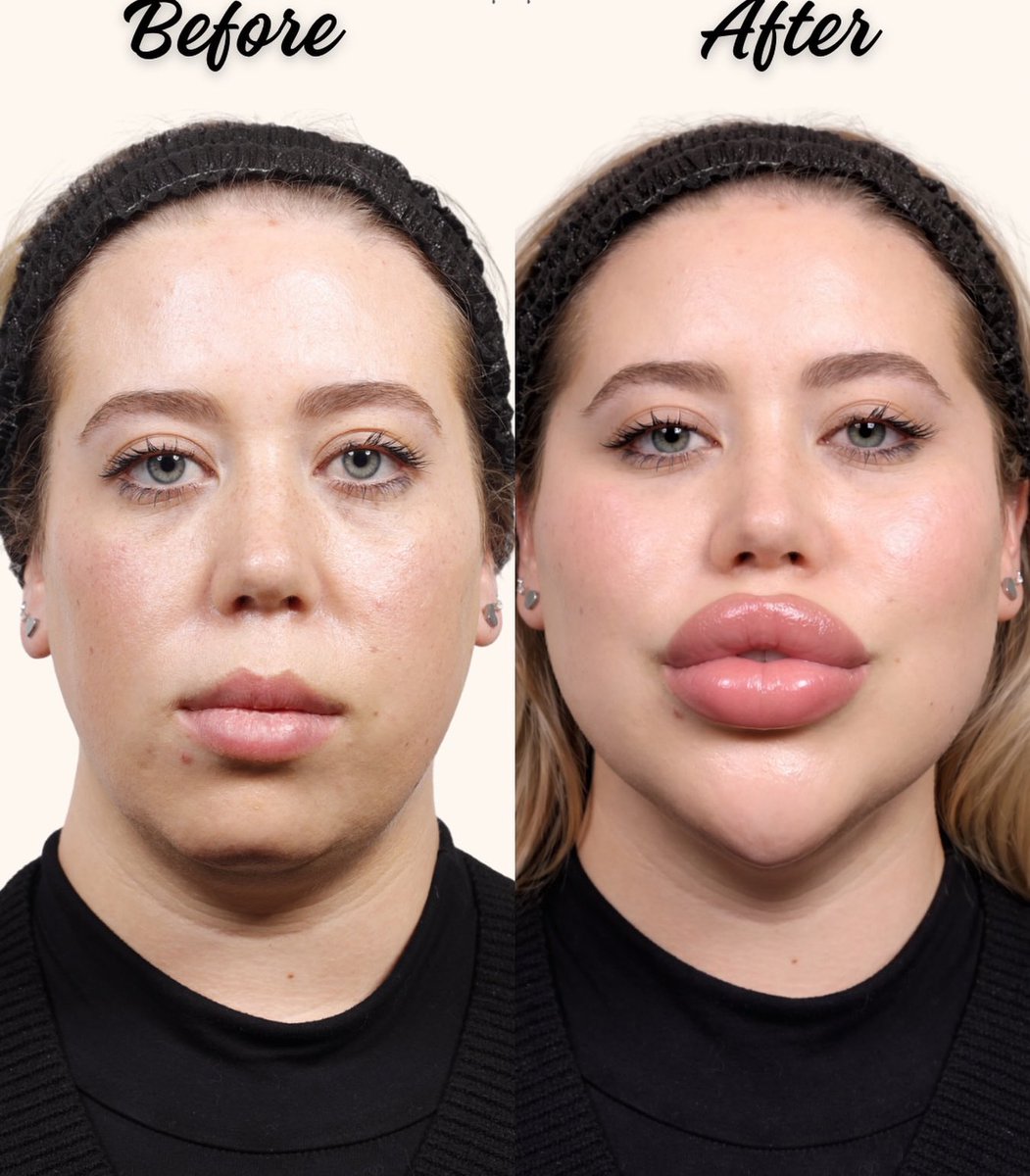 Clown World ™ 🤡 tweet media