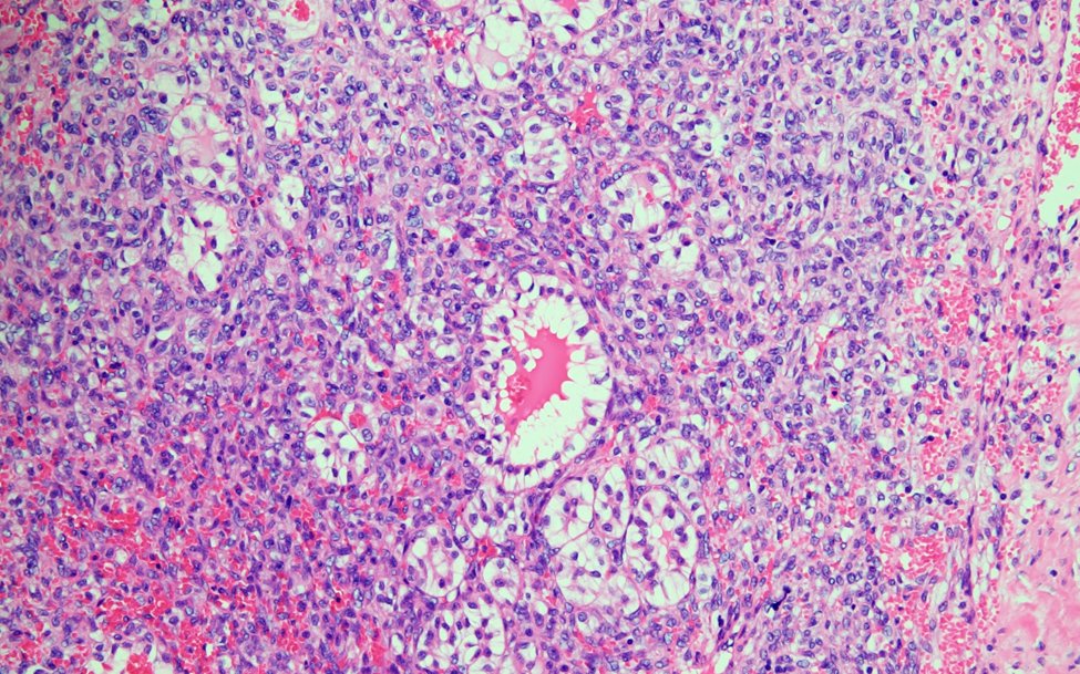 USA Health Pathology tweet media