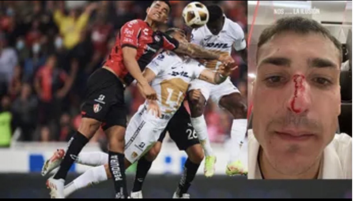 🐐🇫🇷🤠 tweet media