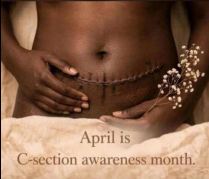 NurseWithCare's tweet photo. "April is C-Section Awareness Month! Let's break the stigma around Cesarean births. Share your C-section story or support a mom who did!
You’re all loved❤️
#CSectionAwareness #CesareanAwarenessMonth" https://t.co/vKKmFWA2jW
