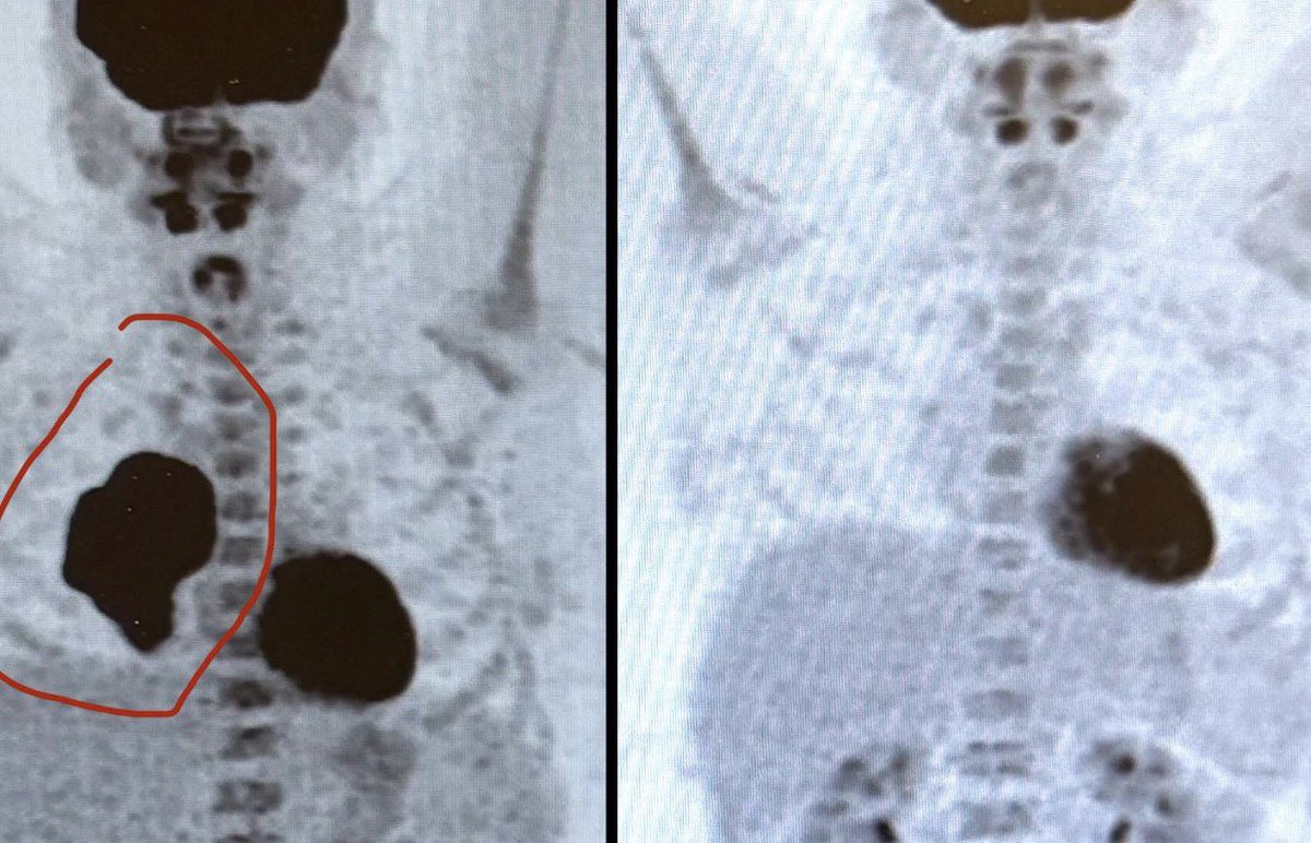 Captain Pickle tweet media