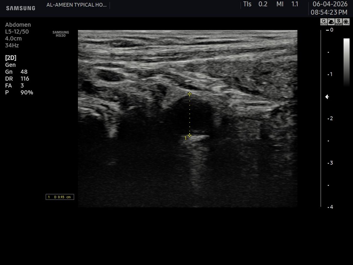 EchoTech_4's tweet photo. 10 years male present with acute abdominal pain.
your opinion?
#EchoTech https://t.co/dUHkAy5cGj