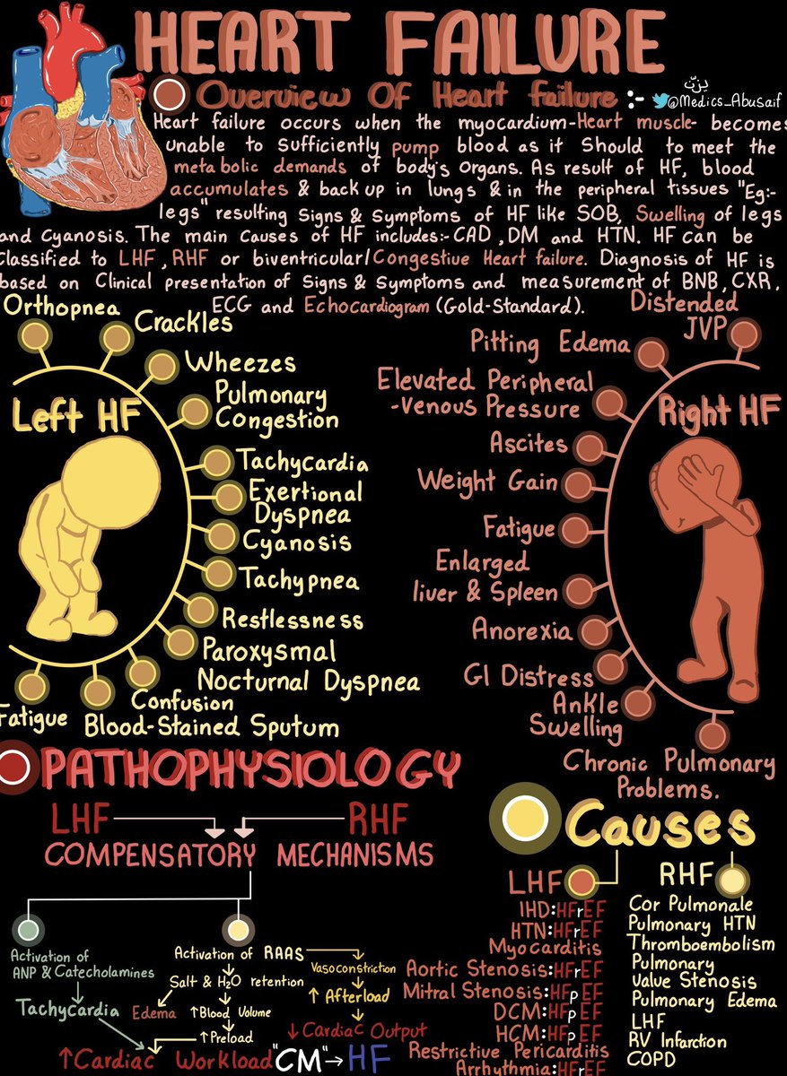 MTD_MED's tweet photo. Overview of Heart Failure. 💡 https://t.co/KMsLpj7Bz2