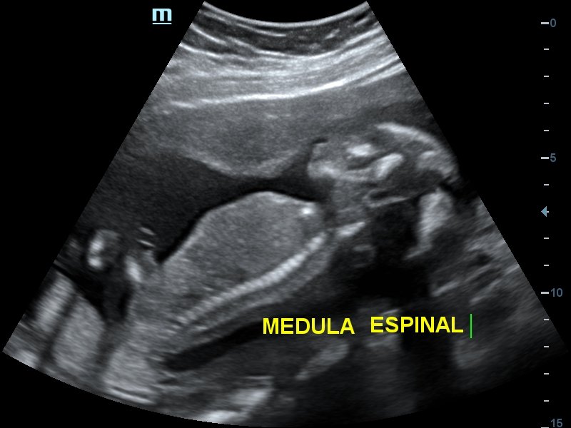 The Mexican Imp (P) 🇲🇽 tweet media