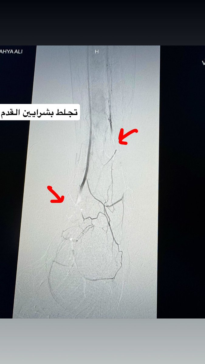 Abdulaziz AlHarbi MD د.عبدالعزيز الحربي tweet media