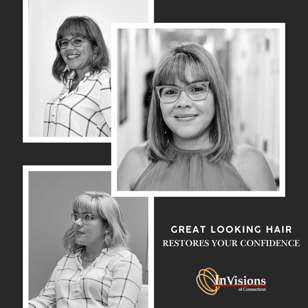 InvisionsHair's tweet photo. Never underestimate how much confidence you can get back when you look in the mirror and see yourself for the first time with a full head of hair.  #ConfidenceBoost #HairTransformation #HairConfidence https://t.co/R3G3oHox4q