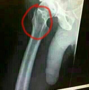 Camarada Batlakers tweet media