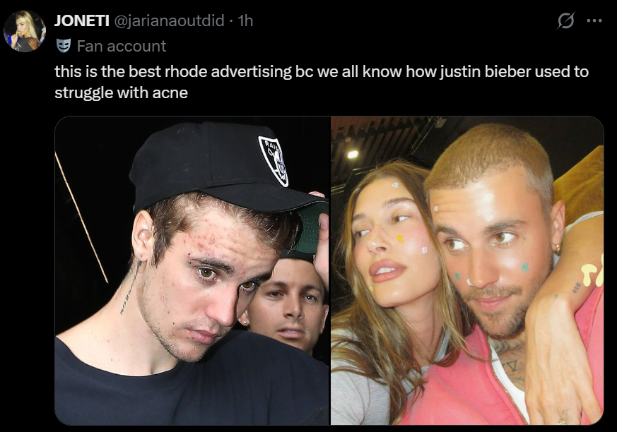 easymoneyrbII's tweet image. yrs later they are still the same

as if JB hadn’t already recovered before 2022. they never tweet about his achievements. he's just a tool to fight Selena stans or prop their fave when convenient