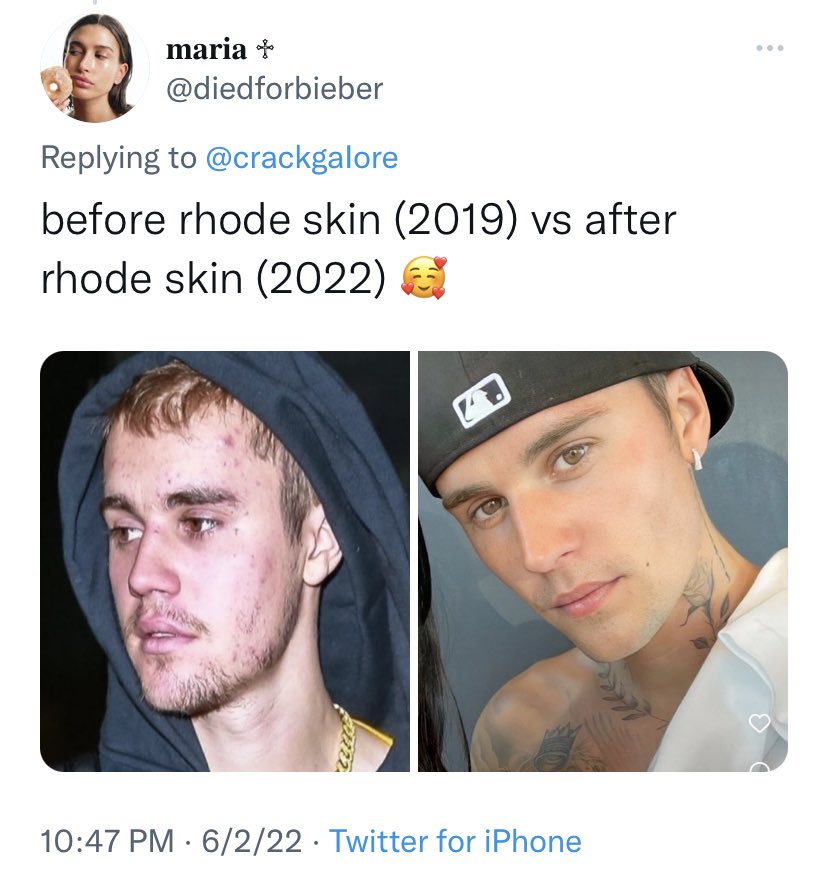 easymoneyrbII's tweet image. yrs later they are still the same

as if JB hadn’t already recovered before 2022. they never tweet about his achievements. he's just a tool to fight Selena stans or prop their fave when convenient