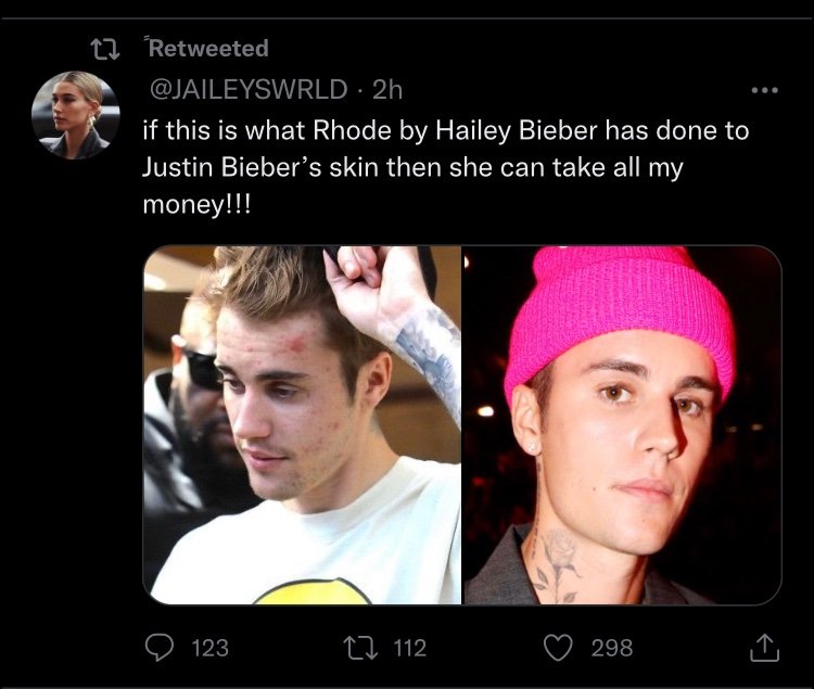 easymoneyrbII's tweet image. yrs later they are still the same

as if JB hadn’t already recovered before 2022. they never tweet about his achievements. he's just a tool to fight Selena stans or prop their fave when convenient