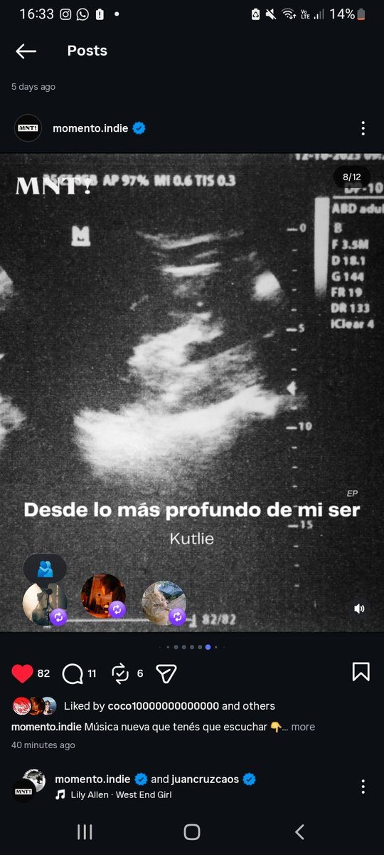 kutlieee (YA SAQUE EL EP ESCUCHENLO) tweet media